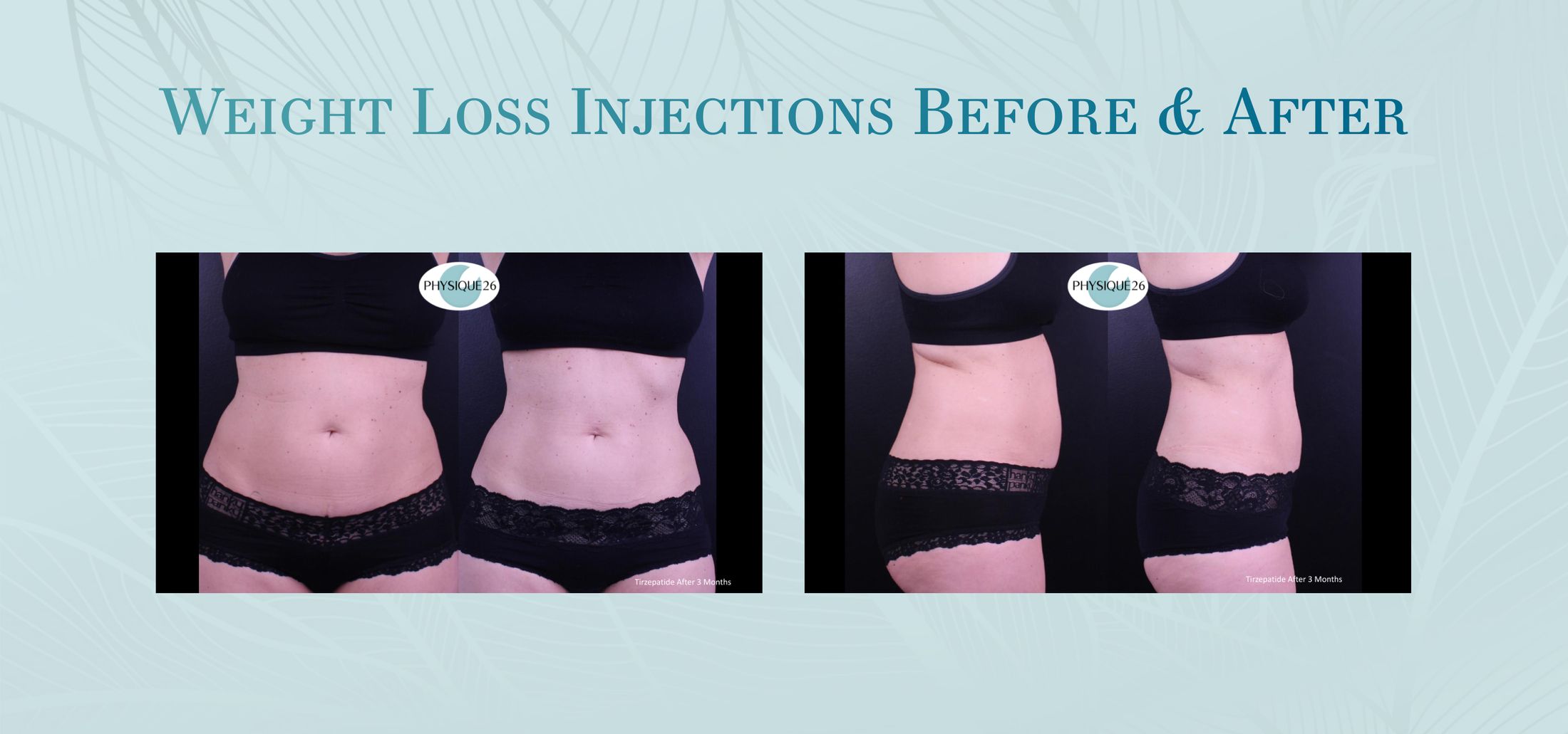 Before and after weight loss injections comparison